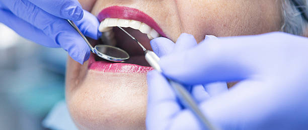 Best Emergency Dentist for Lost Fillings or Crowns in Williamson, WV